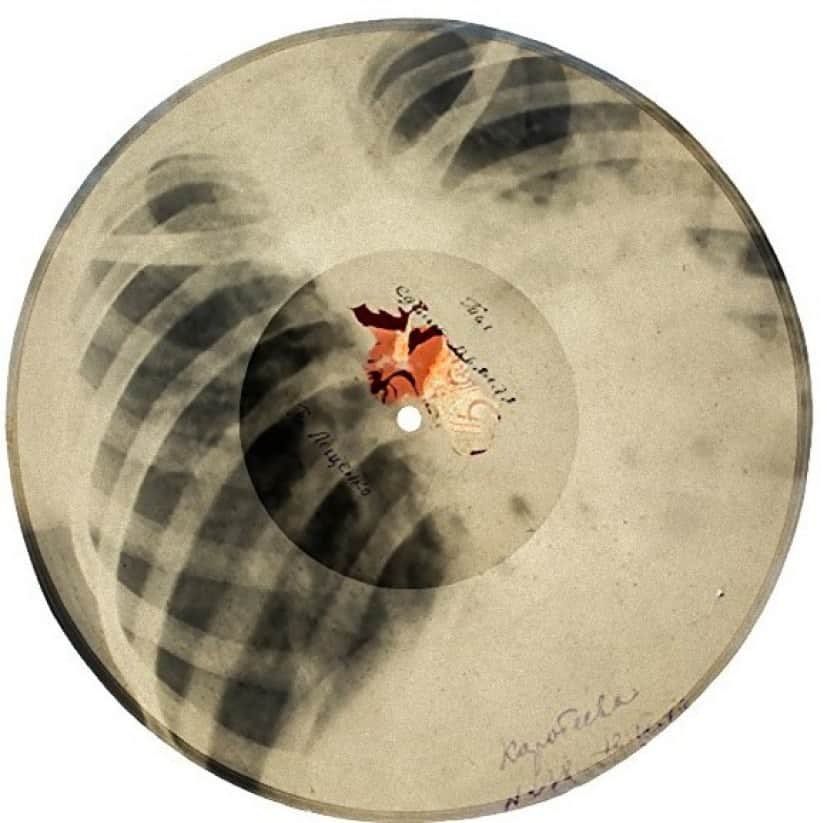 肋骨レコード 1